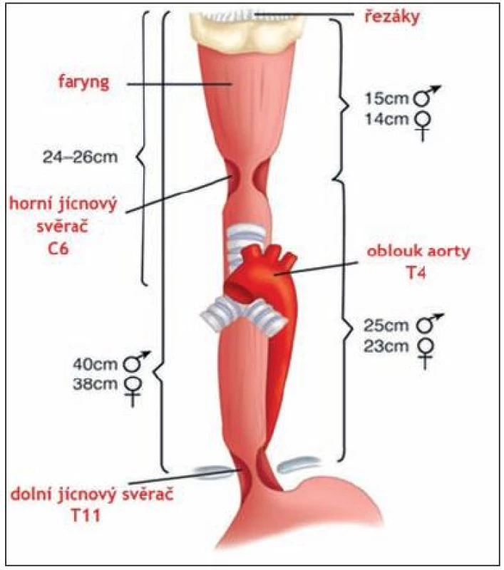 Anatomická zúžení v horním trávicím traktu.
Fig. 1. Anatomic narrowing of the upper digestive tract.