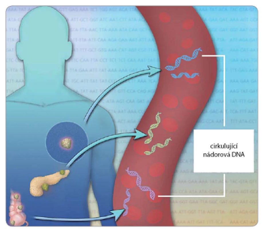 Variabilita ctDNA detekovatelné v krvi pacientů s pokročilým nádorovým onemocněním.
