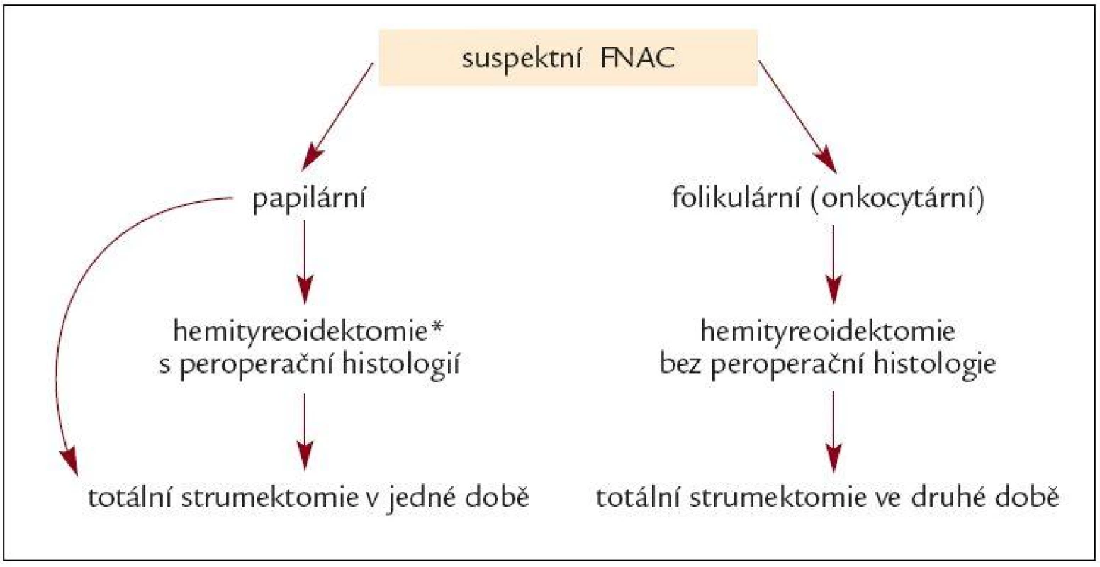 Algoritmus klinického postupu při suspektním výsledku FNAC.