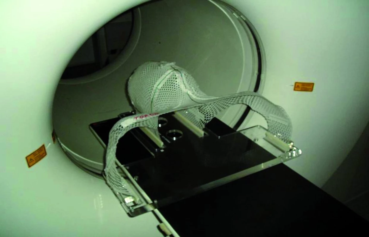 Fixační pomůcky používané při snímkování pomocí PET/CT a následně při ozařování.