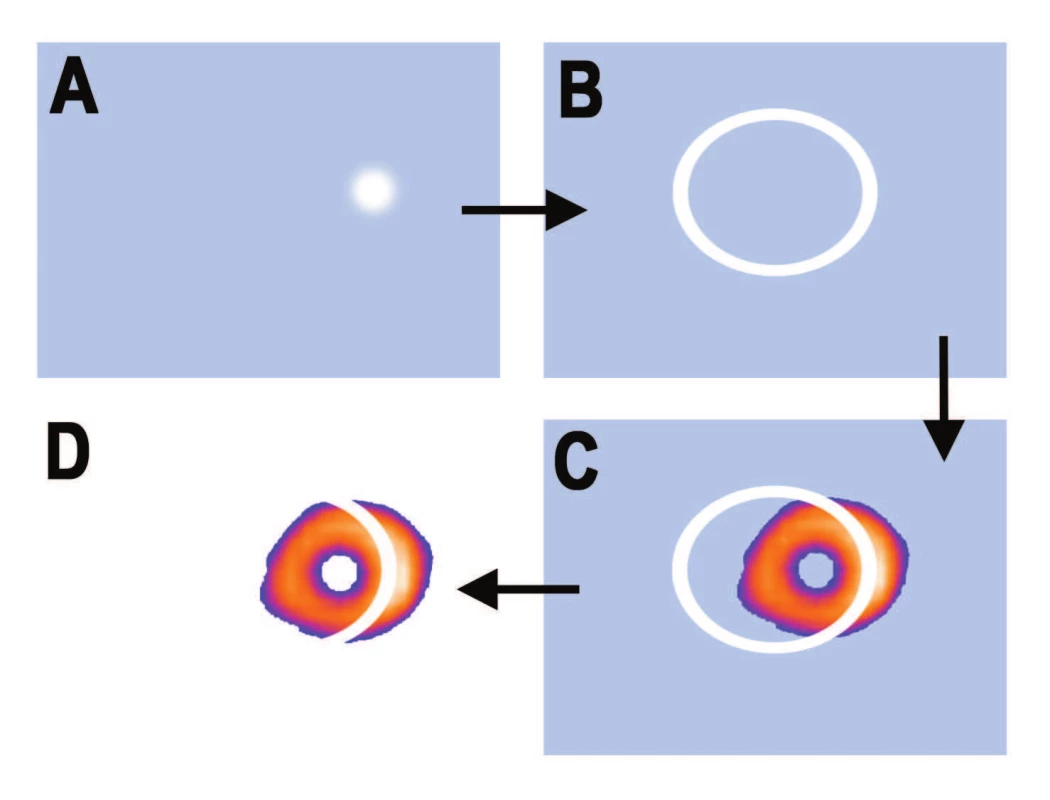 Schéma vzniku artefaktů při nehomogenitě zorného pole gamakamery. A – místo nehomogenity zorného pole; B – kruhový artefakt na zrekonstruovaném SPECTu; C – kruhový artefakt se překrývá při snímání s obrazem myokardu; D – arteficiální defekt na tomografickém řezu myokardem.