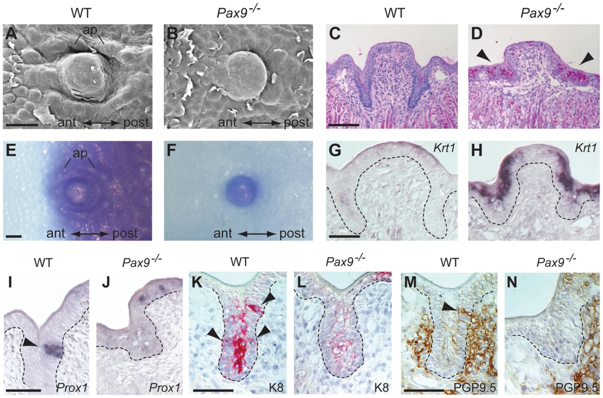 Differentiation defects and lack of proneural induction in the <i>Pax9</i>-deficient CVP trench epithelium.