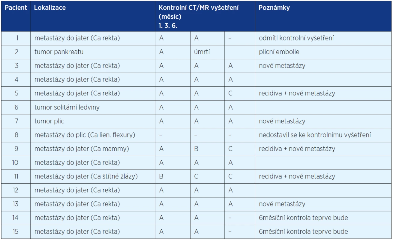 Výsledky CT/MR vyšetření podle modifikovaných RECIST kritérií