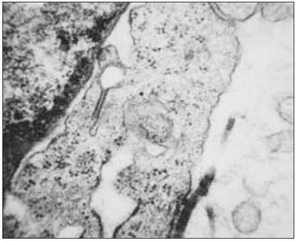 Birbeckova granula v cytoplazmě buněk ve tvaru tenisové rakety. EM, zvětšeno 16 000krát.