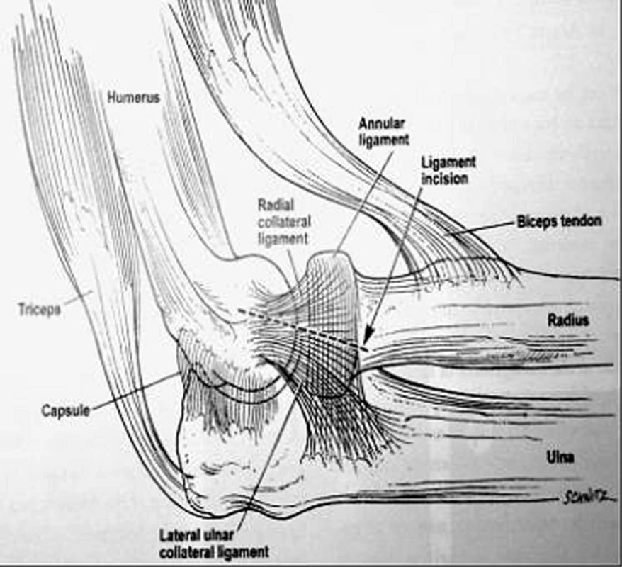 Anatómia letarálneho kolaterálneho ligamenta