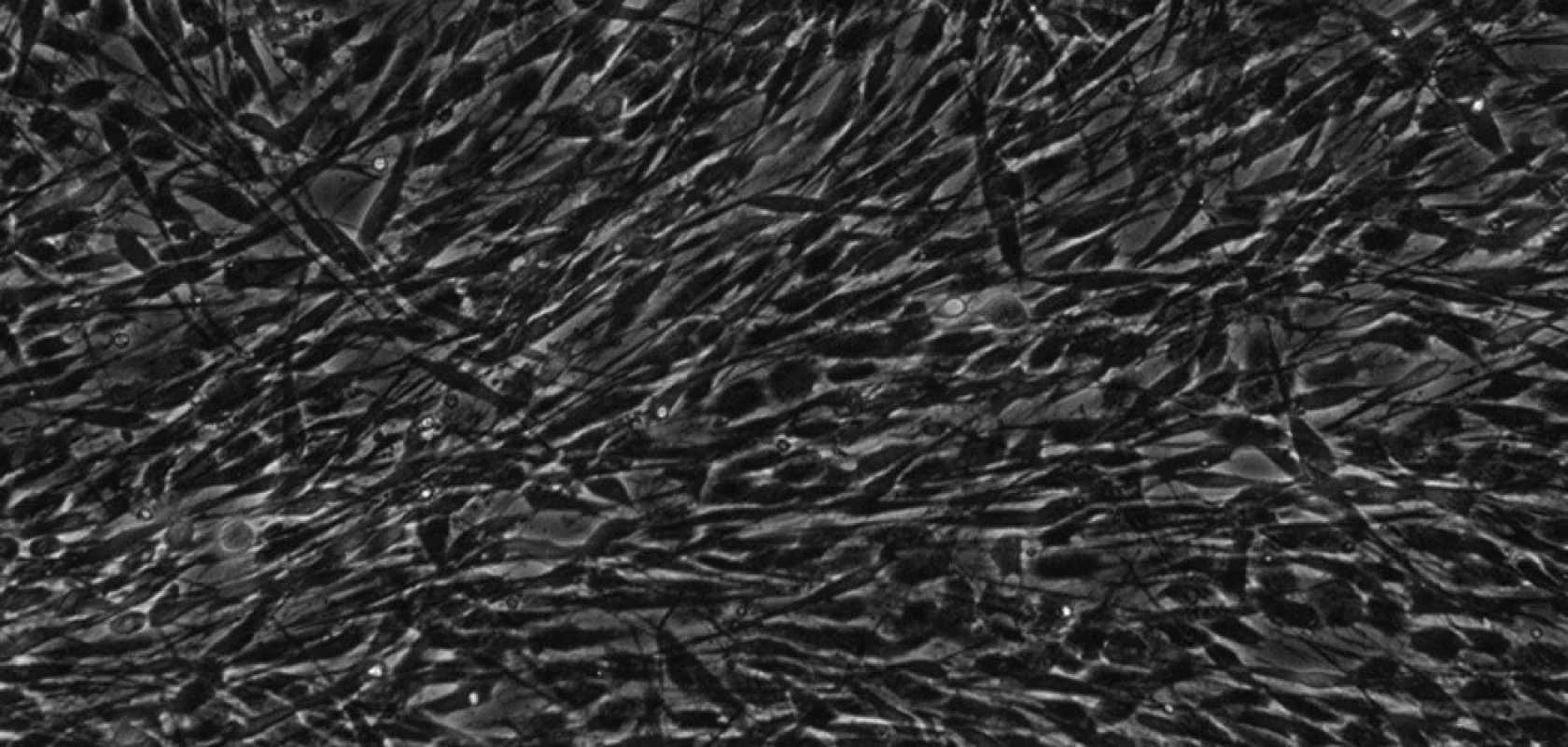 Kmenové buňky zubní pulpy izolované z perivaskulárního kompartmentu při 30. pasáži. Buňky jsou vřetenaté, s dlouhými výběžky a rozvinutým cytoskeletem. KBZP mají v průměru 12 - 18 μm. Mikroskop s fázovým kontrastem, zvětšení 200x.