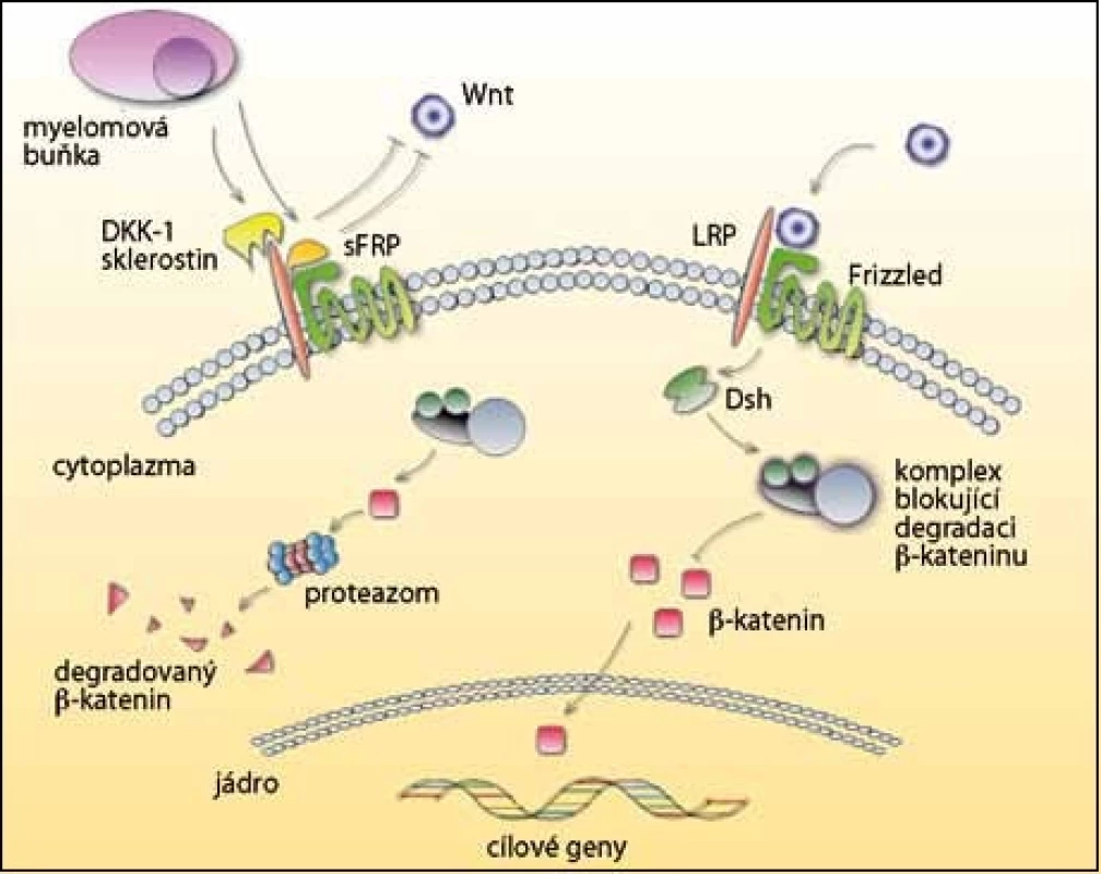 Dráha Wnt a její inhibitory v mnohočetném myelomu. 
V pravé části obrázku je zobrazena situace bez inhibitorů, kdy po navázání Wnt není β-katenin degradován. Přesunutím do jádra se spouští přepis genů pro normální vývoj osteoblastů. V levé části obrázku myelomová buňka produkuje inhibitory DKK-1 a sklerostin, které se vážou na receptor LRP, a sFRP, který blokuje vazbu na Frizzled receptor. Β-katenin není přenesen do jádra, ale degradován v proteazomu, a tak je potlačena  osteoblastogeneze.