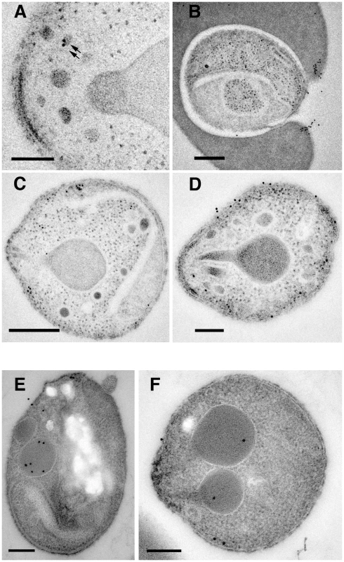 Subcellular localization of PfRipr and PfRh5 by immuno-electron microscopy.