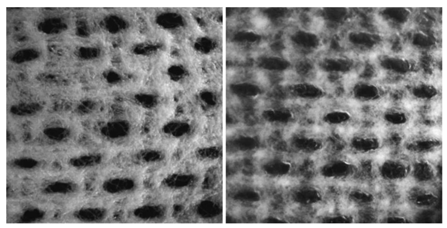 Mikroskopický vzhled krytí při 10násobném přiblížení (vlevo) – struktura krytí v suchém stavu,
vzhled krytí ve vlhkém stavu po 24 hodinách po umístění na umělý model rány (vpravo)