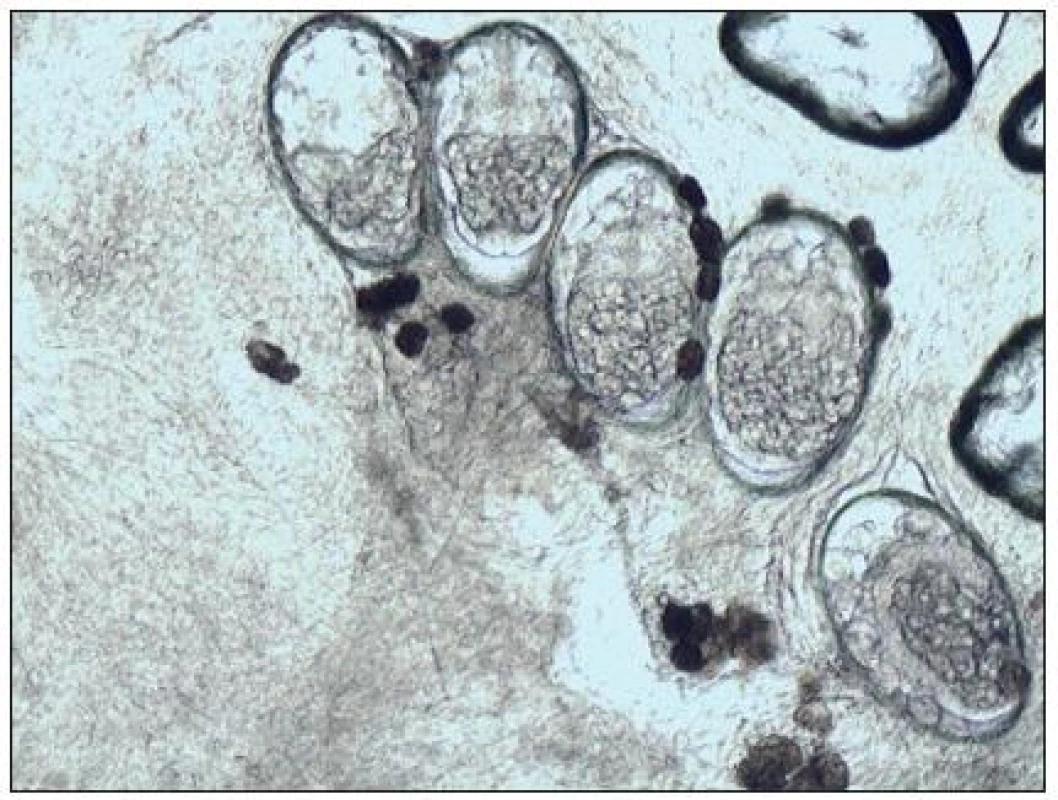 Mikroskopický nález vajíčka s embryami a trus (Danilla T.)
