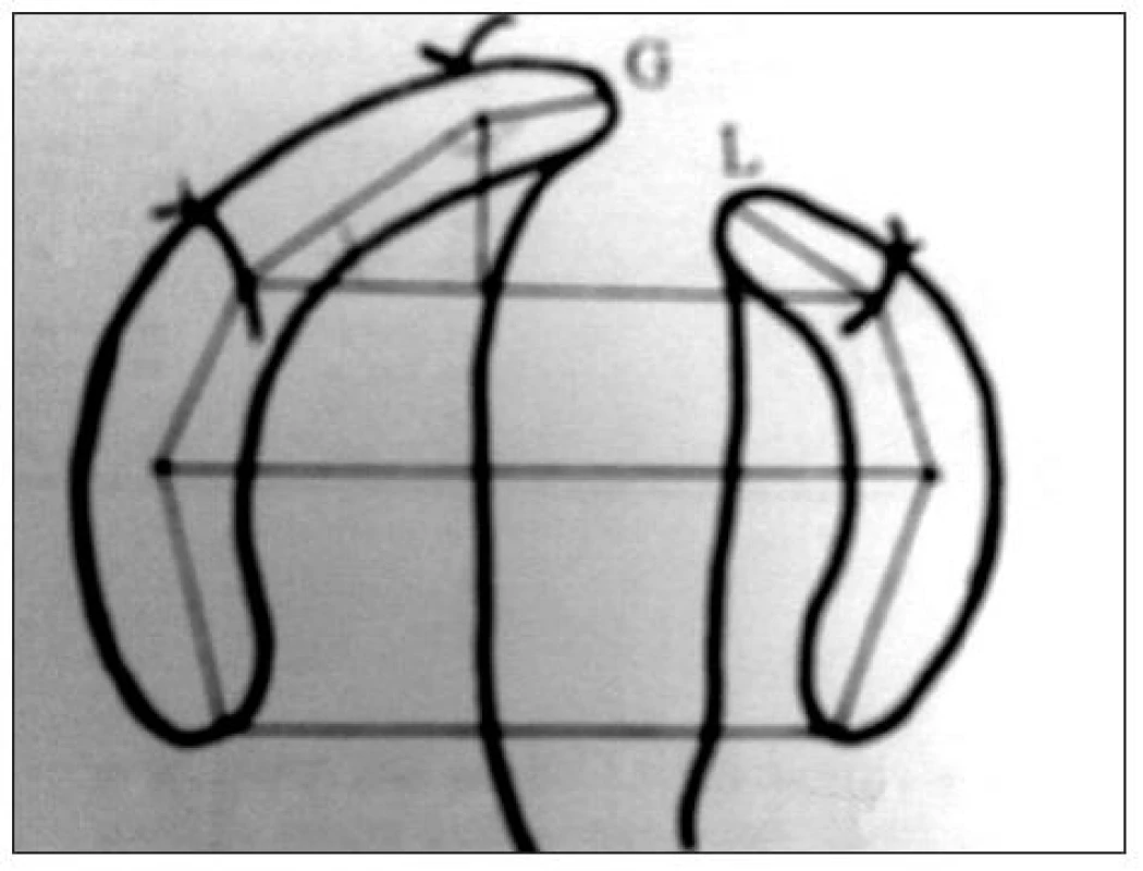 Identifikácia antropometrických bodov; Zdroj: Mazaheri et al. (1971)
Fig. 3. Identification of antropometric points; Source: Mazaheri et al. (1971)