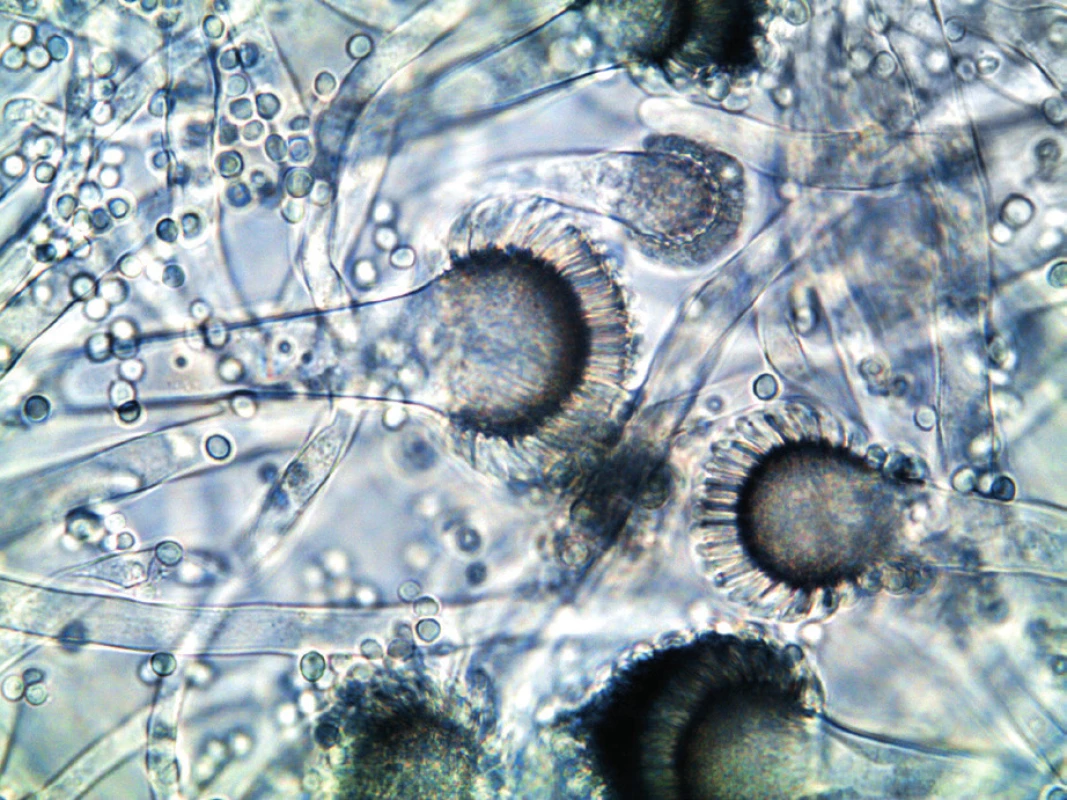 Aspergillus fumigatus v optickém mikroskopu (foto autorka)
Figure 3. Aspergillus fumigatus under an optical microscope (photo by the author)