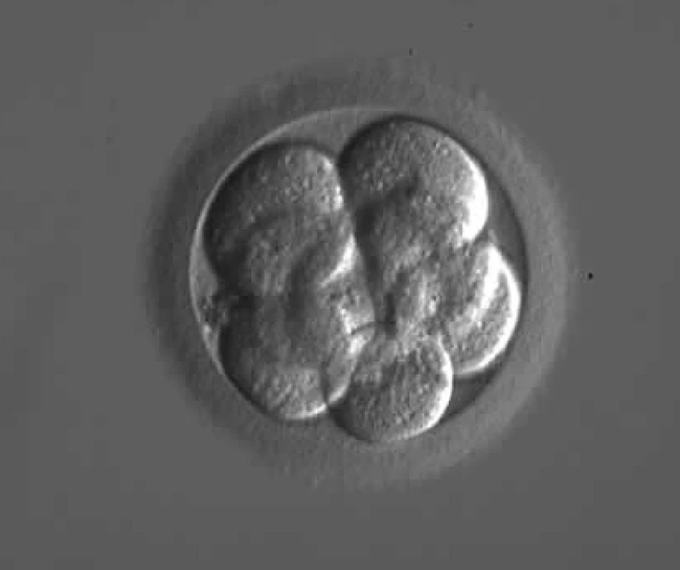 Osmibuněčné embryo 72 hodin po oplození