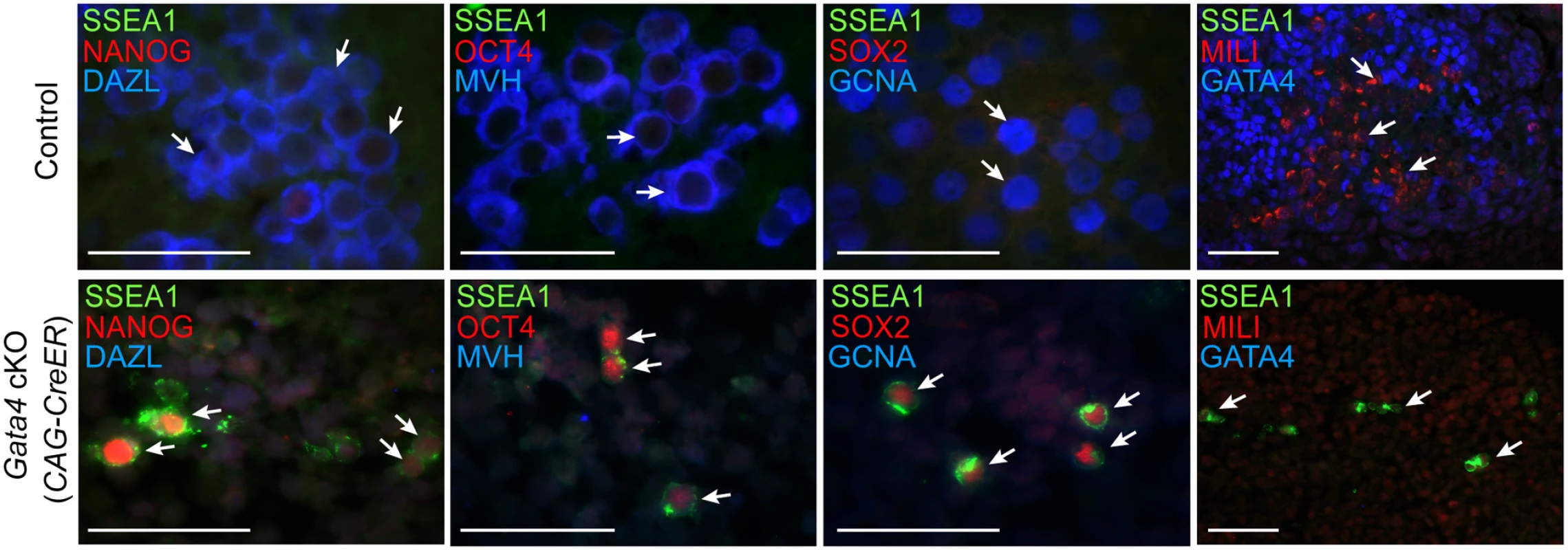Germ cells in <i>Gata4</i> cKO embryos retain characteristics of PGCs.