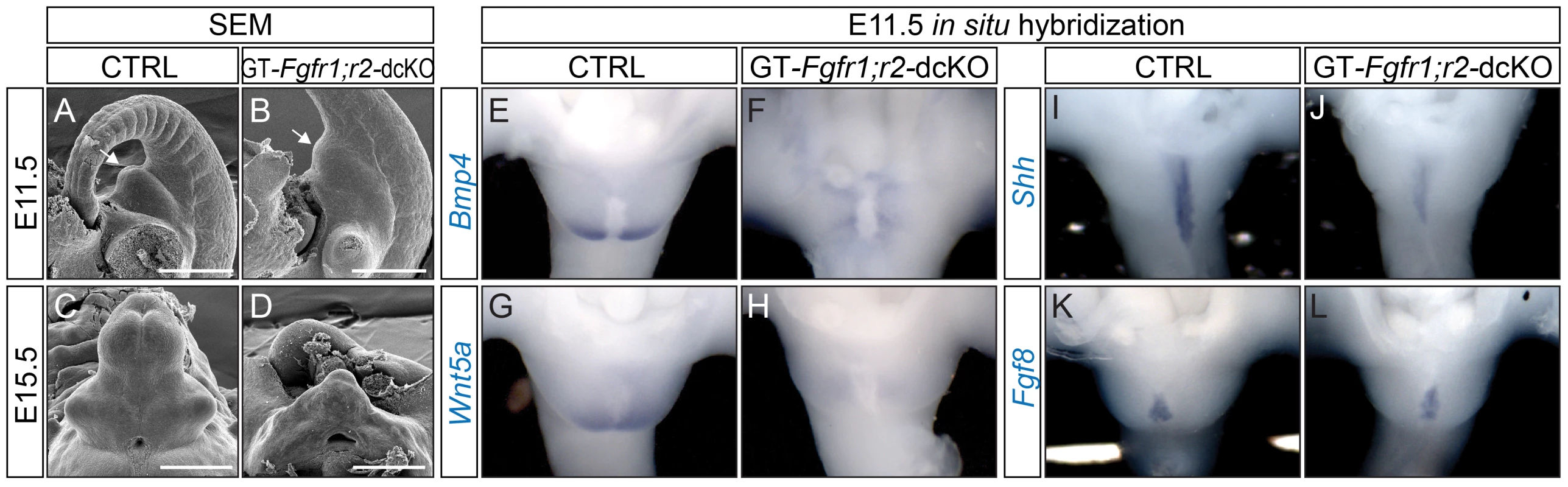 Defective GT development in GT-<i>Fgfr1</i>;<i>r2</i>-dcKO embryos.