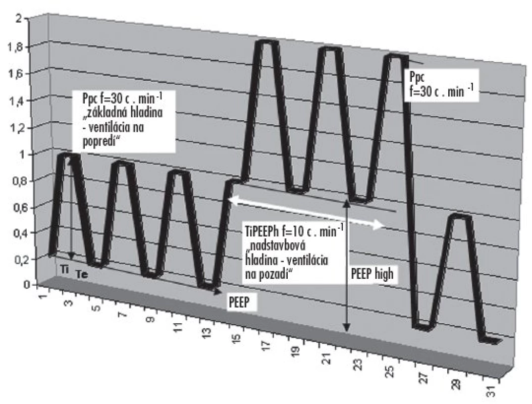 Schematické znázornenie tlakovej krivky pri aplikácii trojhladinovej ventilácie pľúc Základný ventilačný režim (PCV) s frekvenciou 30 d.min-1, a nadstavbová hladina ventilácie na pozadí s frekvenciou 10 d.min-1, tvorená tlakovou hladinou PEEPh / PEEP.