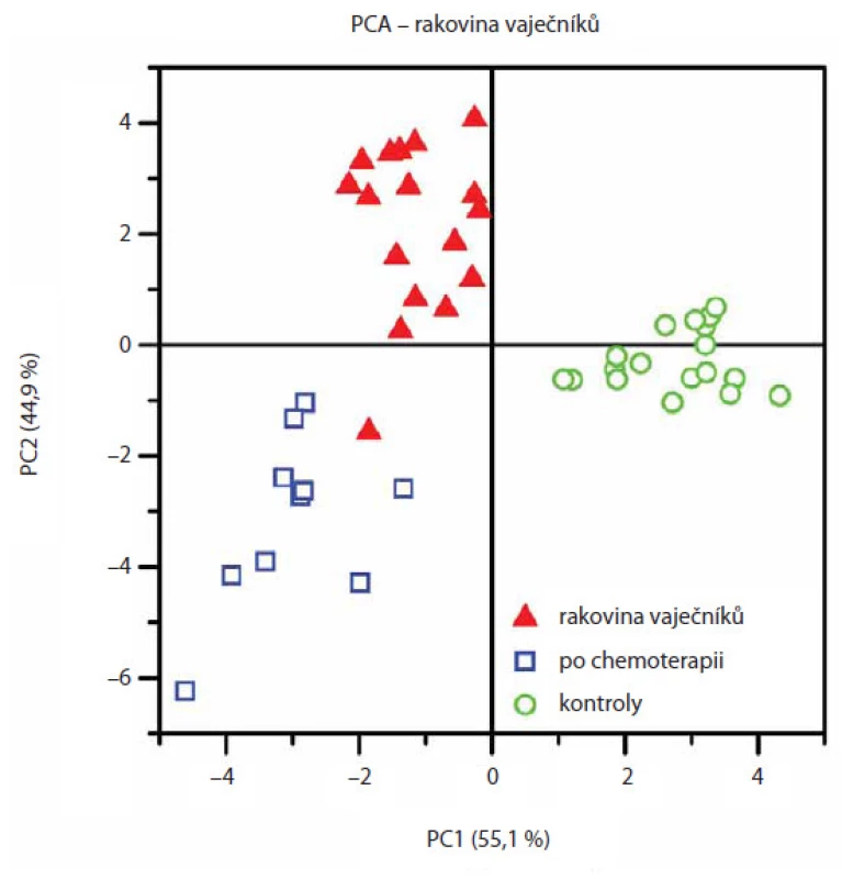 PCA statistické vyhodnocení glykanových map získaných po separaci kapilární elektroforézou umožňuje rozdělení vzorků do odlišných kohortních skupin (stejné skupiny pacientek a kontrol jako u obr. 3). Převzato z [13].