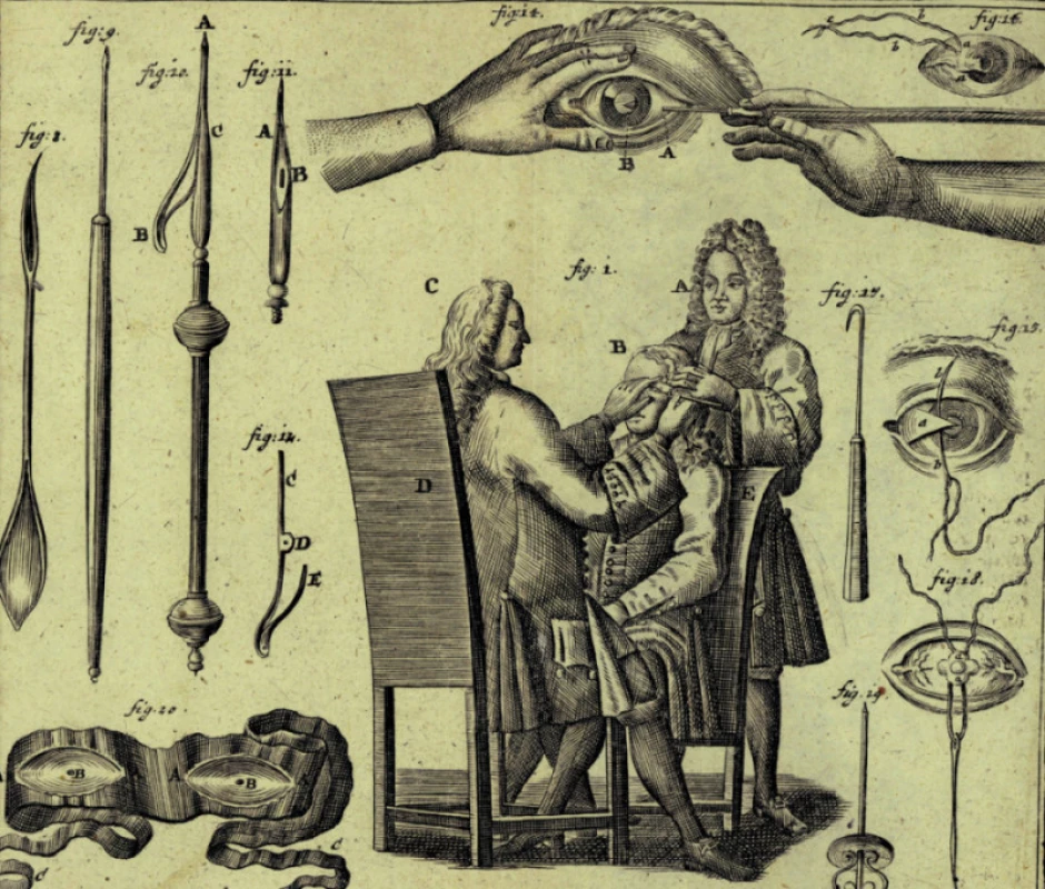 Oční operace a instrumentárium používané v 18. století. (Z knihy: Lorenz Heister, Chirurgie, vydáno v Norimberku 1731)
