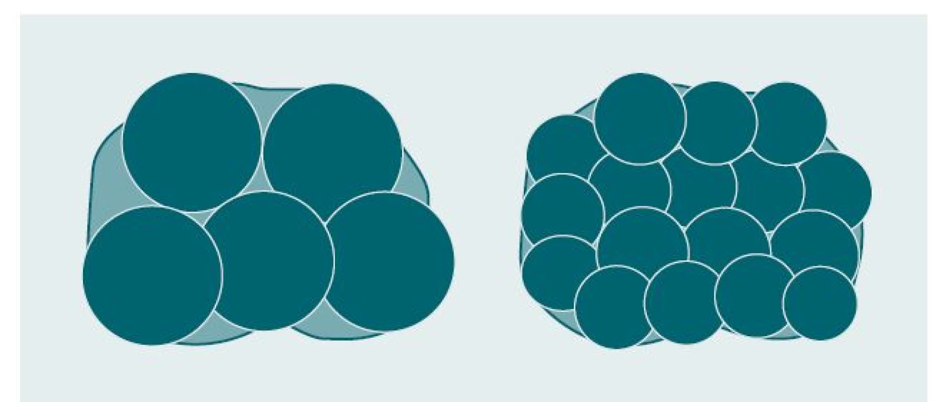 Srovnání velikosti ice-balls vytvořených s použitím kryosond (vlevo) a pomocí kryojehel (vpravo).