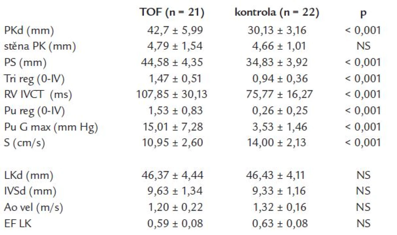 Srovnání hlavních echokardiografických parametrů pacientů po radikální korekci TOF a kontrolní populace bez srdečního onemocnění.