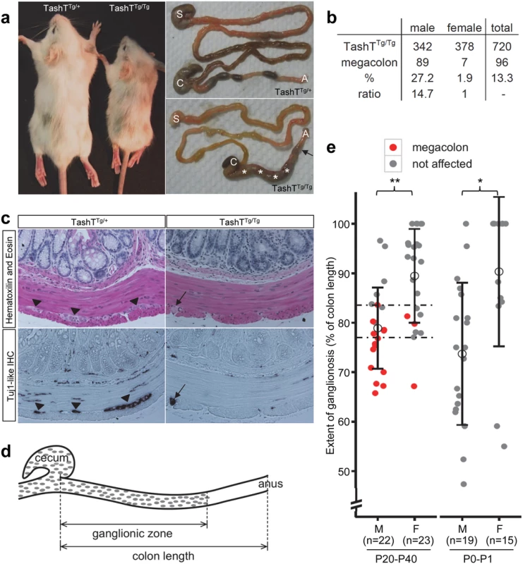 The TashT mouse line is a model for male-biased aganglionic megacolon.