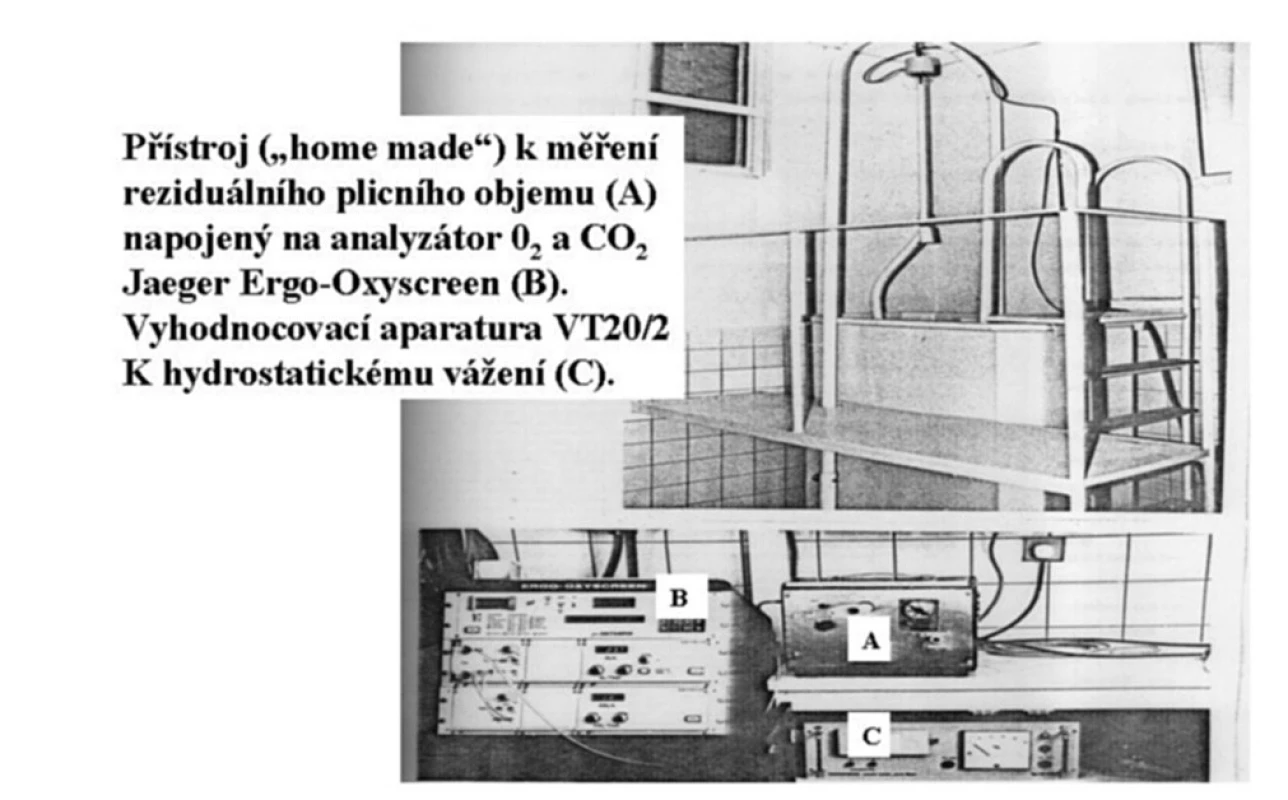 Hydrodenzitometrie, jak byla zkompletována v roce 1988