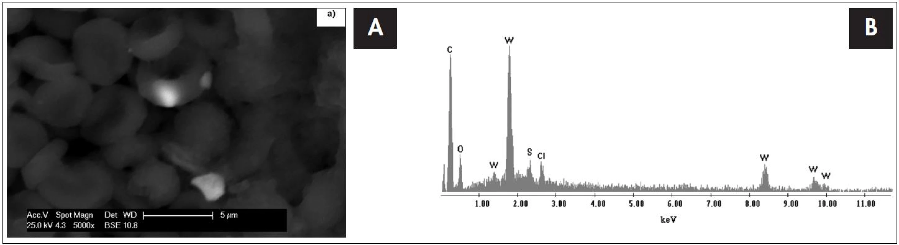 Snímek tkáně mozkového nádoru (glioblastom) s erytrocyty ze skenovacího elektronového mikroskopu s EDS detektorem s odpovídajícím EDS spektrem, který je výsledkem bodové analýzy. Píky označené písmenem W dokazují přítomnost nanočástice s obsahem wolframu v erytrocytu.
