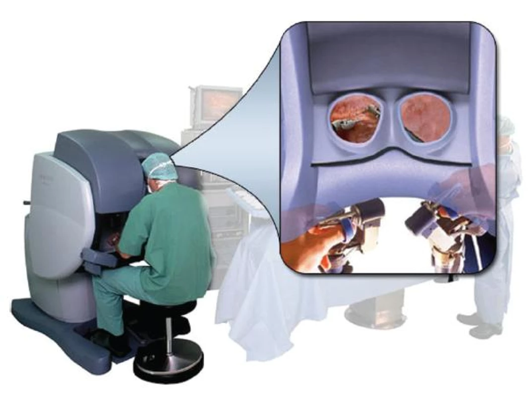 Chirurg při operaci
Fig. 2: The robotic surgeon