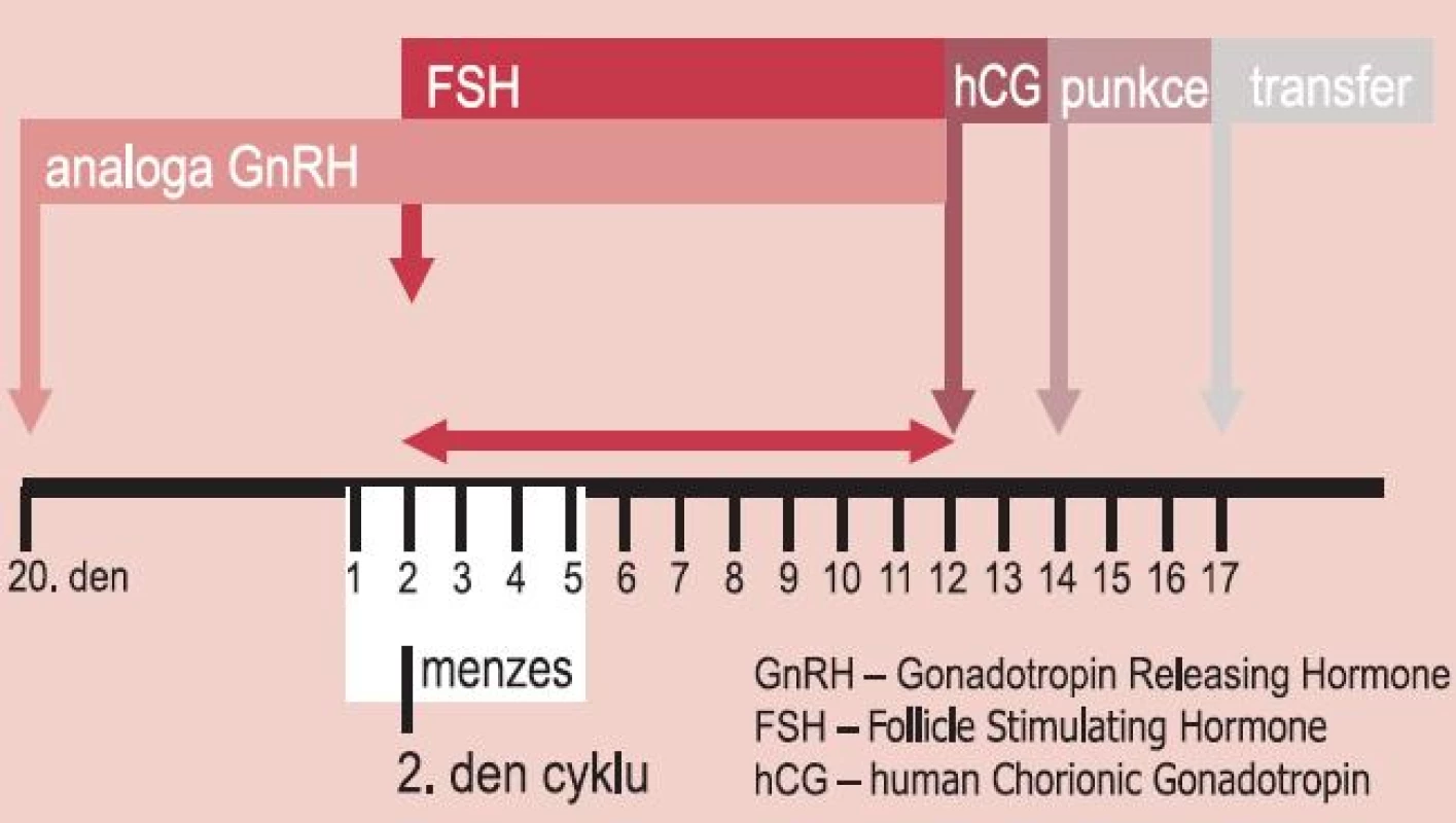 Schéma aplikace GnRH analog a folikulostimulačního hormonu v dlouhém protokolu.