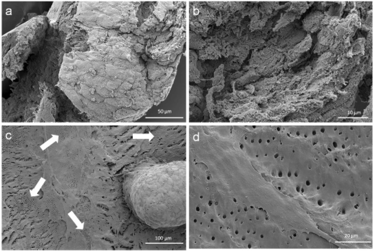 Scanning electron microscopic sphere and cell investigation. SEM images of the outer epithelial-like shell of a cell sphere (a) and the less organized cells with a higher production of extracellular matrix inside the sphere (b). Figure (c) shows a pulp sphere attached onto bovine dentin with a high number of outgrowing, multilayered cells as well as flat spread out and attached cells on bovine root dentin (d). The white arrows in figure (4c) highlight the dentin tubule-like holes in the cell multi-layer.