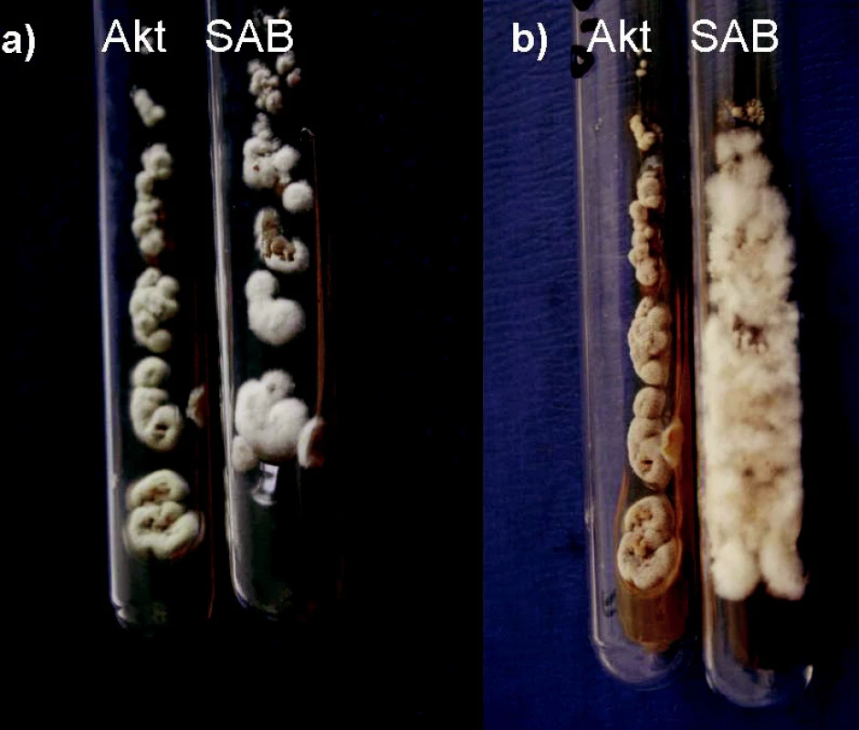 a, b. Onychocola canadensis, primokultúry, masívne rastúce z nechtov pacientky (Akt = agar s aktidionom, SAB = Sabouraudov agar, 25 °C); a) po 4 týždňoch, b) po 11 týždňoch (foto Ing. K. Furdíková)
Fig. 2 a, b. Onychocola canadensis, primocultures, massive growth of the agent from nail specimens (Akt = actidion agar, SAB = Sabouraud agar, 25 °C); a) after 4 weeks b) after 11 weeks (photo K. Furdíková)