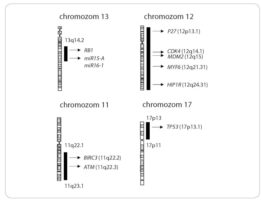 Rekurentní cytogenetické změny u CLL s vyznačením nejvýznamnějších zasažených genů na jednotlivých chromozomech (podle Puiggros et al, 2014) [116].