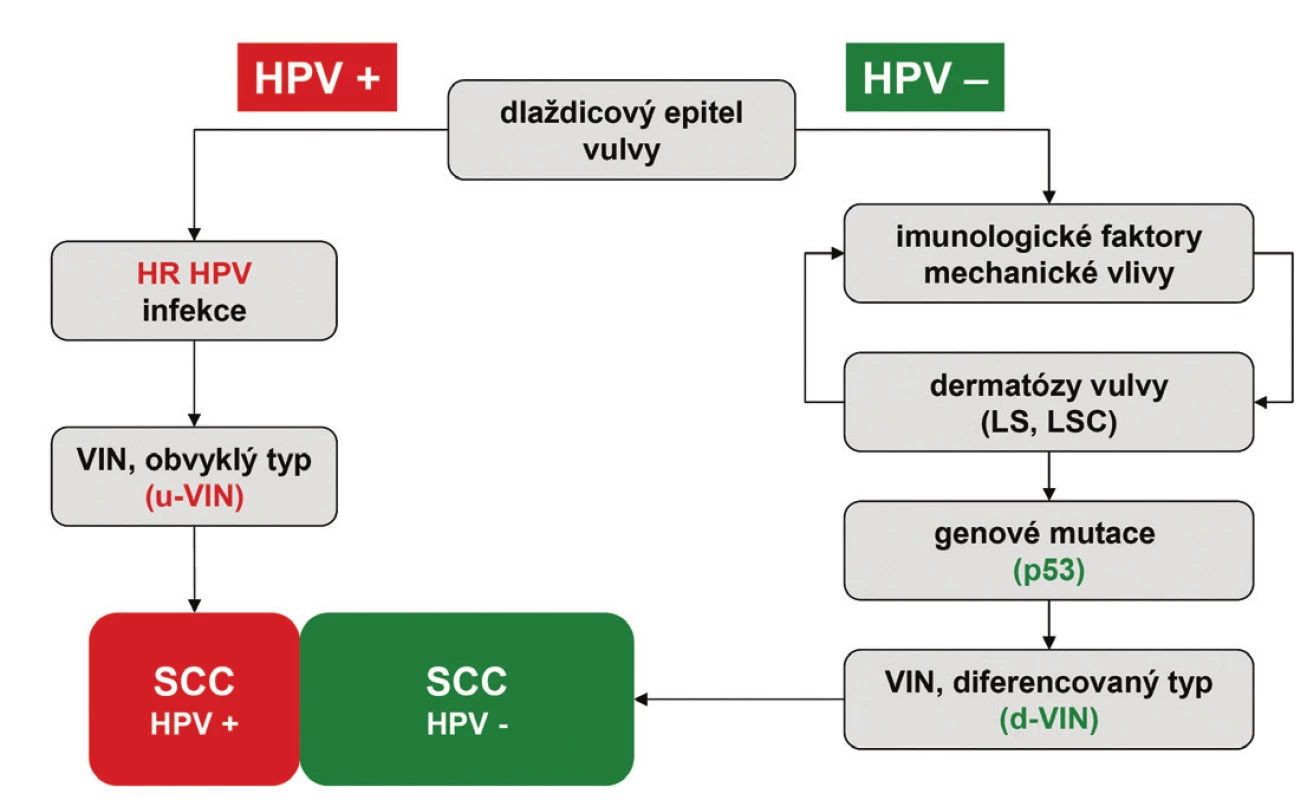 Grafické znázornění dvou hlavních cest etiopatogeneze SCC vulvy. u-VIN – vulvární intraepiteliální neoplázie obvykleho typu; d-VIN – vulvární intraepiteliální neoplázie diferencovaného typu; LS – lichen sclerosus; LSC – lichen simplex chronicus; SCC – dlaždicobuněčný karcinom; HPV – lidský papillomavirus; HR HPV – vysoce rizikové typy lidského papilomaviru