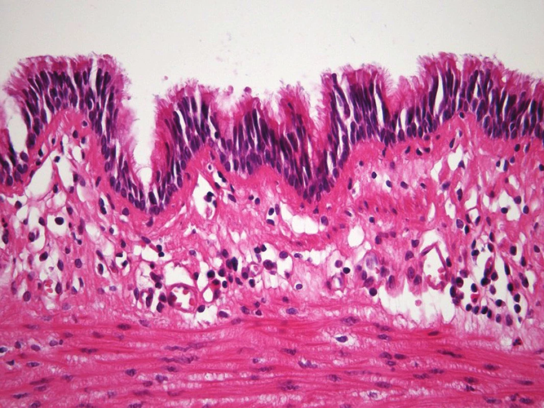 Histologie, H-E barvení, bronchiální epitel
Fig. 6: Histology, H-E staining showing bronchial epithelium