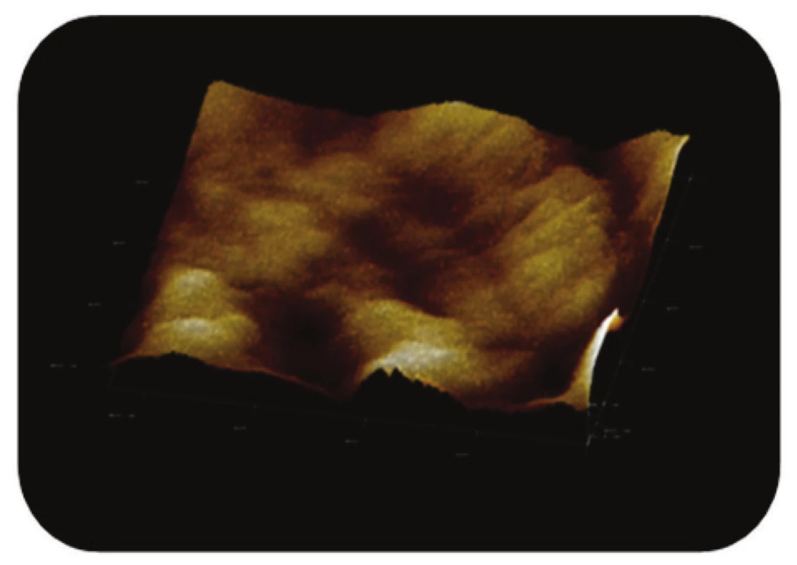 Trojrozměrné zobrazení AFM skenu detailu povrchu magnetického nosiče P(HEMA-GMA)-NH&lt;sub&gt;2&lt;/sub&gt;,režim zobrazení: výškový profil, skenovaná oblast 0,86x0,86 μm&lt;sup&gt;2&lt;/sup&gt;, Z-rozsah 20 nm.