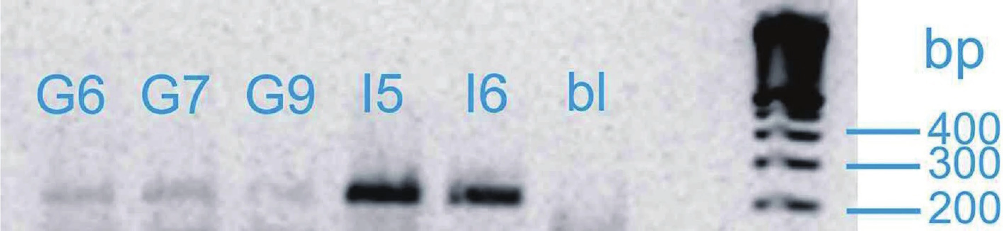 Vizualizace genu SHB
Fig. 1. Visualization of SHB gene