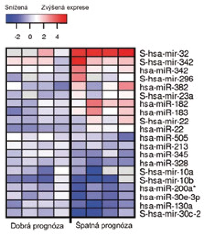 Skupina miRNA umožňující rozdělit pacienty s cRCC na skupiny s dobrou a špatnou prognózou. Červená a modrá barva znamená zvýšenou, resp. sníženou expresi dané miRNA ve srovnání s nenádorovou renální tkání. Předpona S znamená prekurzorovou formu dané miRNA. Upraveno podle Petilla et al [41].