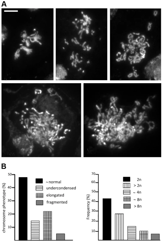 RNAi against <i>Top2</i> disrupts mitotic division in larval brains.