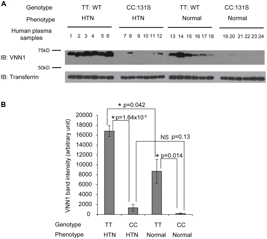 The vanin-1 expression in human plasma samples is closely linked with both genotypic N131S mutation and phenotypic HTN.