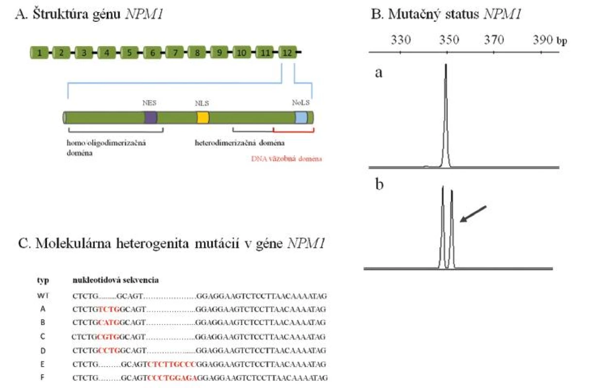 (A) Schéma štruktúry génu NPM1 s detailom na 12. exón, v ktorom sa sústreďujú prevažne 4-nukleotidové inzerčné mutácie zodpovedné za abnormálnu cytoplazmatickú lokalizáciu proteínu NPM1. (B) Analýza mutačného statusu NPM1 pomocou fragmentačnej analýzy. Posunové mutácie NPM1 sa prejavujú nálezom ďalšieho píku, ktorý je oproti štandardnej alele najčastejšie predĺžený o 4 nukleotidy (a – vzorka bez mutácie s nálezom štandardnej alely NPM1, b – vzorka s mutáciou NPM1). Šípka naznačuje mutovanú alelu NPM1, ktorá je prítomná spoločne so štandardnou alelou. (C) Molekulárna heterogenita mutácií v géne NPM1. Sú znázornené najčastejšie typy inzerčných mutácií v géne NPM1 (typ A až F). Vložené nukleotidy sú zvýraznené červene. V súčasnosti je popísaných aspoň 55 rôznych posunových mutácií NPM1 (22). Uvedené príklady analýzy mutačného statusu NPM1 predstavujú mutačné profily pacientov, ktorí boli vyšetrení v Laboratóriu molekulárnej biológie Hemato-onkologickej kliniky FNOL v rámci diagnostiky AML. NES – nuclear export signal (jadrový exportný signál), NLS – nuclear localization signal (jadrový lokalizačný signál), NoLS – nucleolar localization signal (jadierkový lokalizačný signál), bp – bázové páry, WT – wild-type (štandardná) alela.