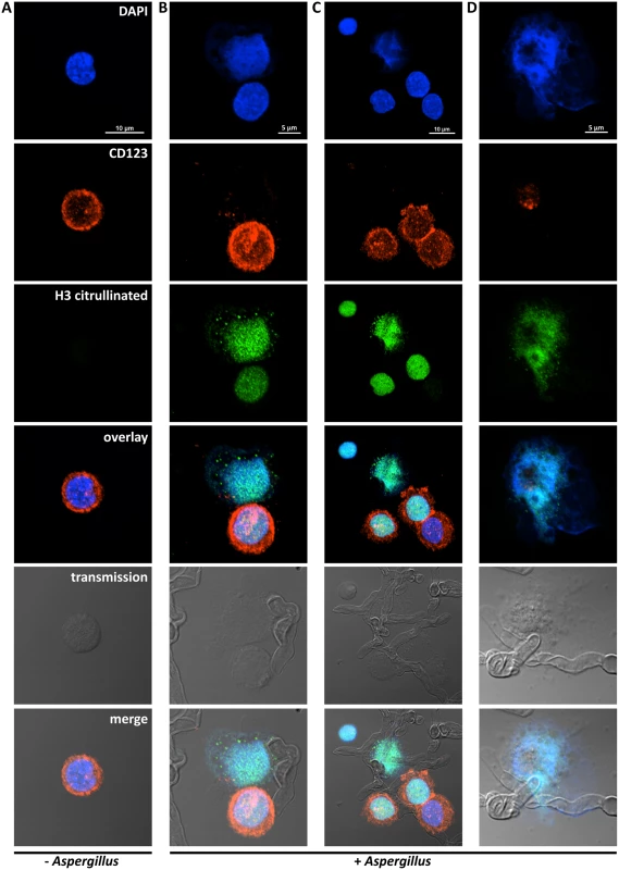 Detection of pDC extracellular traps (pETs) by immunofluorescence.