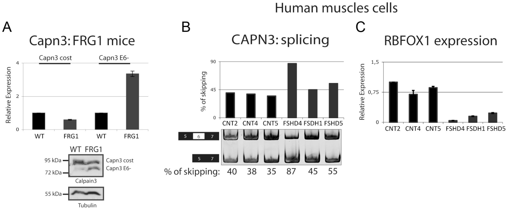 Alternative splicing isoform of <i>Calpain 3</i> increased in <i>FRG1</i> mice and in FSHD patients.