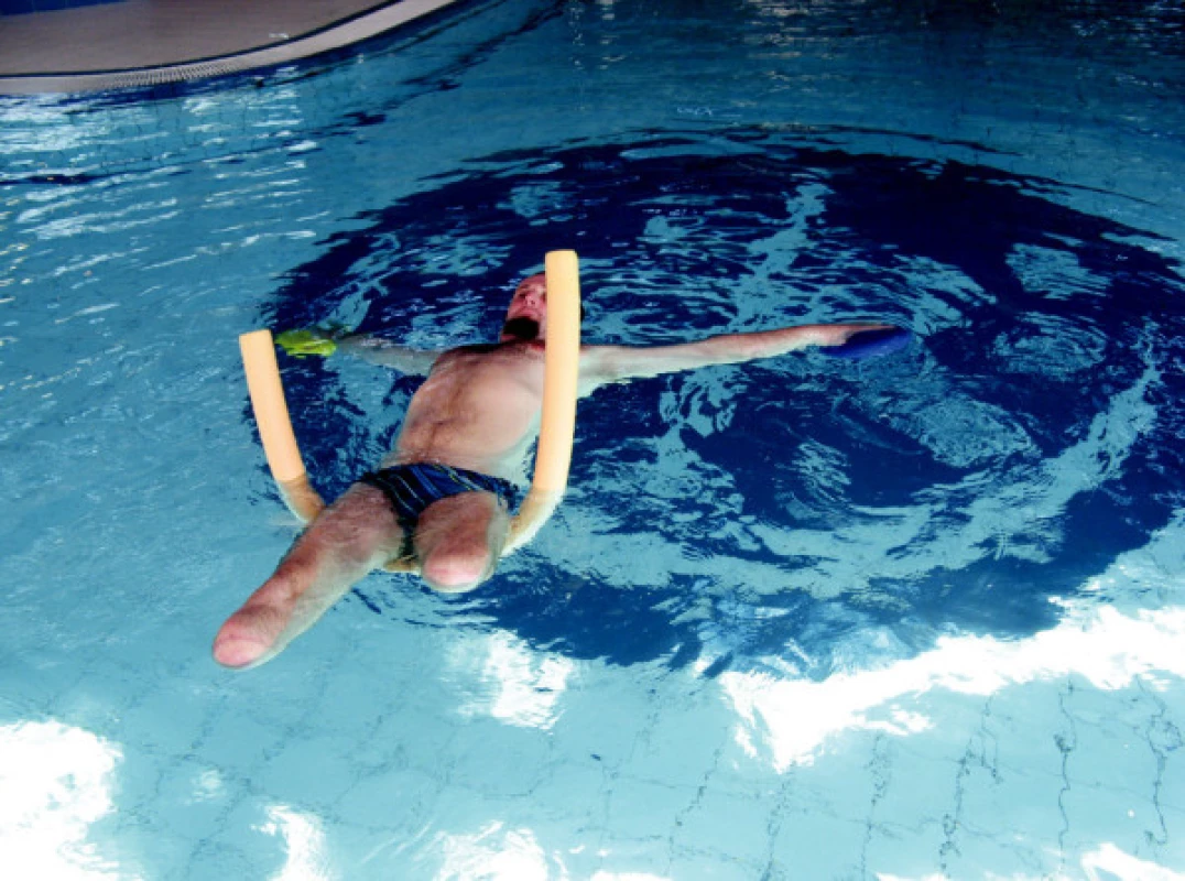 Pacient po amputaci PDK ve stehně a LDK v bérci – cvičení v bazénu pod vedením fyzioterapeuta.