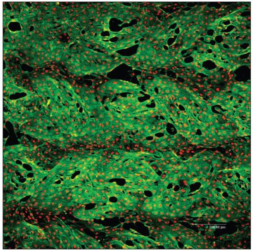 Konfluentní vrstva endotelových buněk bovinní linie CPAE 7. den po nasazení na PET cévní protéze (VÚP,
Brno, ČR) modifikované vrstvou kolagenu a fibrinu. Zelená: cytoskelet, červená: buněčná jádra. Konfokální mikroskop Leica TCS SP2 AOBS, 60x1 μm, zvětšení 10x, nasazeno 50x10&lt;sup&gt;3&lt;/sup&gt; buněk/cm&lt;sup&gt;2&lt;/sup&gt;, primární protilátka anti ß-aktin 1:400 (Sigma), sekundární protilátka Alexa Fluor 488 2 mg/ml (Invitrogen), Propidium Iodid 5 μg/mL