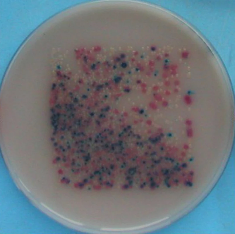 Kultivační nálezy na otisku, chromogenní půda Uri-Select 4
Tyrkysově modrá – Streptococcus agalactiae, počet kolonií 10–100 CFU/25 cm&lt;sup&gt;2&lt;/sup&gt;, růžová – Escherichia coli, počet kolonií 10 000 CFU/25 cm&lt;sup&gt;2&lt;/sup&gt;, tmavě modrá – Enterococcus faecalis, počet kolonií 100–1000 CFU/25 cm&lt;sup&gt;2&lt;/sup&gt;, bezbarvá až průzračná – Pseudomonas aeruginosa, počet kolonií 10 000 CFU/25 cm&lt;sup&gt;2&lt;/sup&gt;
Fig. 4: Results of microbial cultivation: chromogenic medium Uriselect 4 
Turquoise blue - Streptococcus agalactiae, number of colony 10–100 CFU/25 cm&lt;sup&gt;2&lt;/sup&gt;, pink – Escherichia coli, number of colony 10 000 CFU/25 cm&lt;sup&gt;2&lt;/sup&gt;, dark blue – Enterococcus faecalis, number of colony 100–1000 CFU/25 cm&lt;sup&gt;2&lt;/sup&gt;, colourless, clear – Pseudomonas aeruginosa, number of colony 10 000 CFU/25 cm&lt;sup&gt;2&lt;/sup&gt;