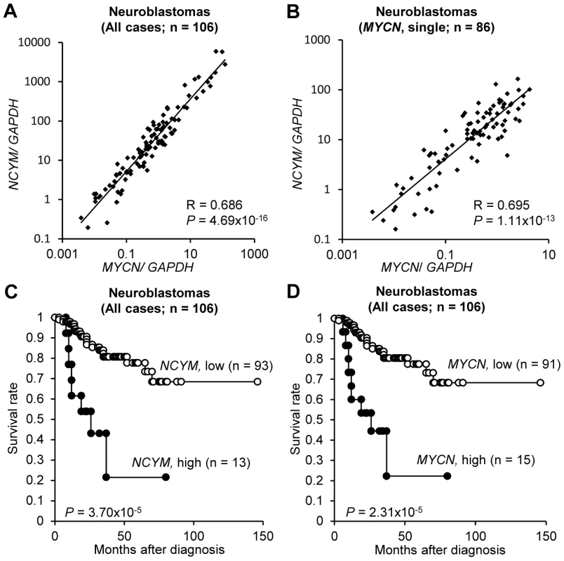 <i>NCYM</i> expression is associated with poor prognosis in human neuroblastoma.
