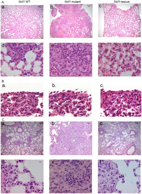 <i>Ncf1</i> mutation leads to severe lung damage in response to BCG infection.