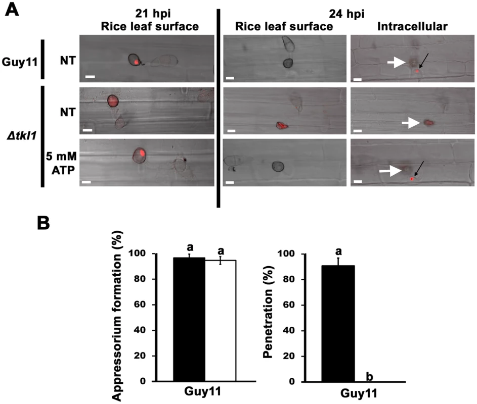 <i>TKL1</i> is required for the migration of appressorial nuclei into primary hyphae in host cells.