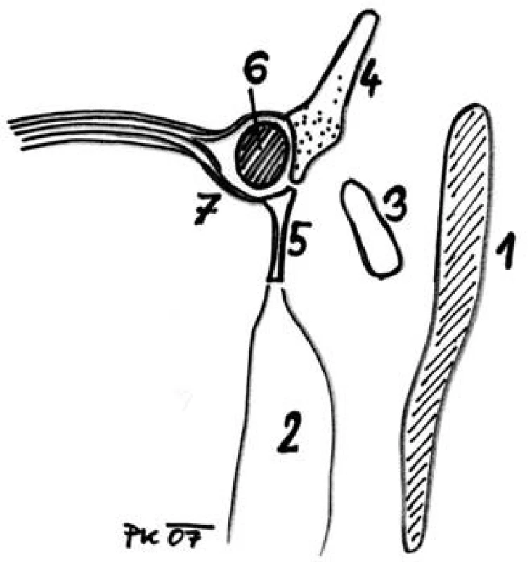 Axiální průřez vnitřním koutkem. 1 – concha nasi media, 2 –bulla ethmoidalis, 3 - processus uncinatus, 4 – processus frontalis maxillae, 5 – os lacrimale, 6 – saccus lacrimalis, 7 – ligamentum canthi mediale.

