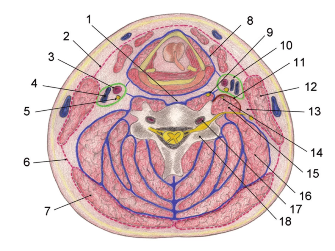 Schematický řez krkem [4]
Vysvětlivky: 1 – zadní hluboká krční fascie, přední část; 2 – střední krční fascie, přední část; 3 – krční tepna; 4 – vnitřní jugulární žíla; 5 – bloudivý nerv; 6 – střední krční fascie, zadní část; 7 – trapézový sval; 8 – hluboká přední (viscerální) fascie; 9 – střední krční sympatické ganglion; 10 – alární fascie; 11 – skalenická fascie; 12 – kývač ; 13 – mezifasciální prostor; 14 – brániční nerv; 15 – skalenické svaly; 16 – zdvihač lopatky; 17 – obratlová tepna; 18 – tělo obratle.